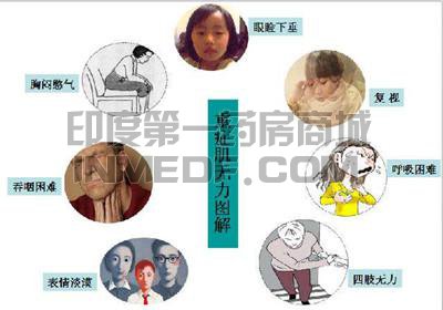 11种治疗重症肌无力(MG)的药物